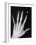 Hand Bones-Simon Jarratt-Framed Photographic Print