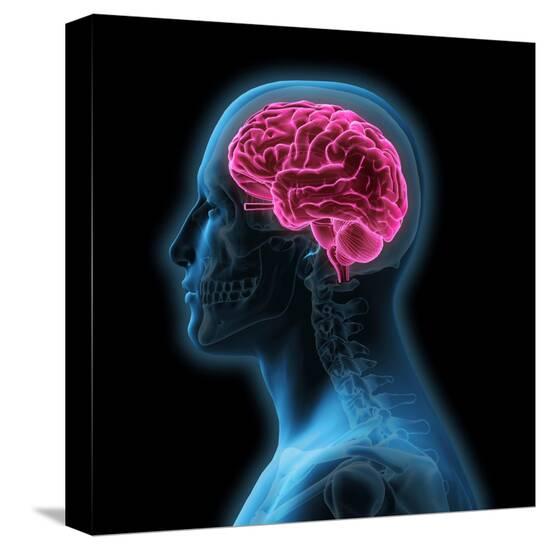 Stretched Canvas Print, , large