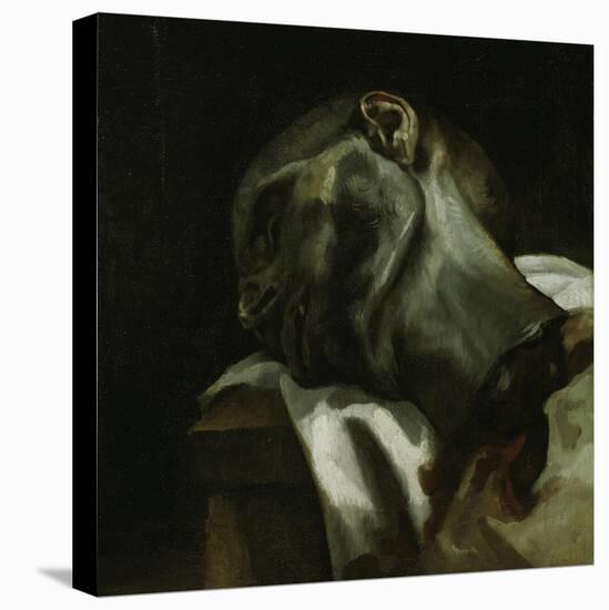 Head of a Guillotined Man, 1818-19-Theodore Gericault-Stretched Canvas