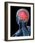 Headache, Conceptual Artwork-SCIEPRO-Framed Photographic Print