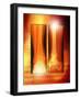 Healing Ankle Fracture, X-ray-Miriam Maslo-Framed Photographic Print