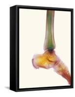 Healthy Ankle, X-ray-Science Photo Library-Framed Stretched Canvas