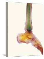 Healthy Ankle, X-ray-Science Photo Library-Stretched Canvas