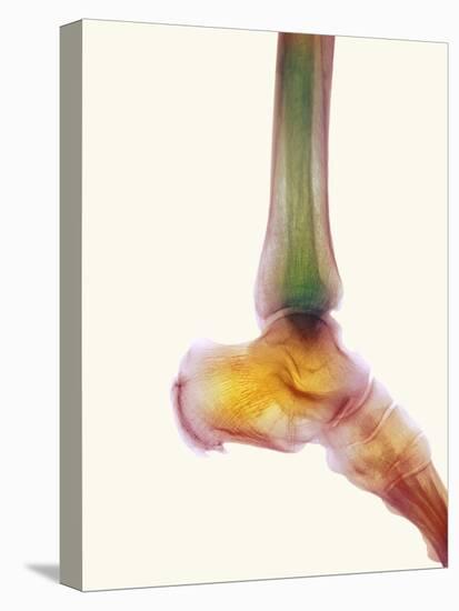 Healthy Ankle, X-ray-Science Photo Library-Stretched Canvas