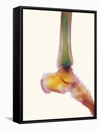 Healthy Ankle, X-ray-Science Photo Library-Framed Stretched Canvas