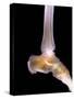 Healthy Ankle, X-ray-Science Photo Library-Stretched Canvas