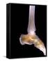 Healthy Ankle, X-ray-Science Photo Library-Framed Stretched Canvas