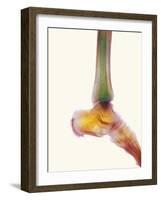 Healthy Ankle, X-ray-Science Photo Library-Framed Photographic Print