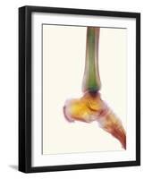 Healthy Ankle, X-ray-Science Photo Library-Framed Photographic Print