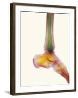 Healthy Ankle, X-ray-Science Photo Library-Framed Photographic Print