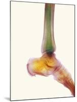 Healthy Ankle, X-ray-Science Photo Library-Mounted Photographic Print