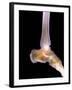 Healthy Ankle, X-ray-Science Photo Library-Framed Photographic Print