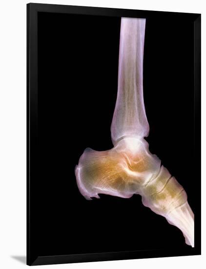 Healthy Ankle, X-ray-Science Photo Library-Framed Photographic Print