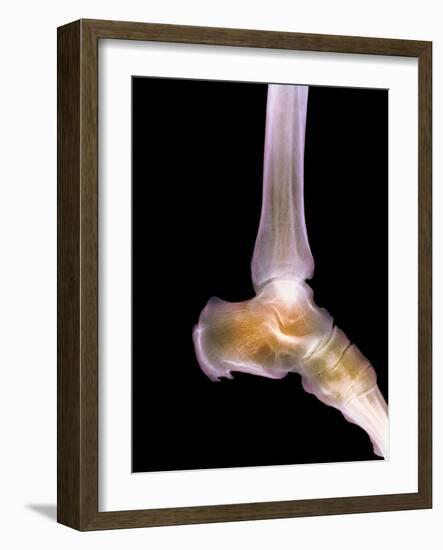 Healthy Ankle, X-ray-Science Photo Library-Framed Photographic Print