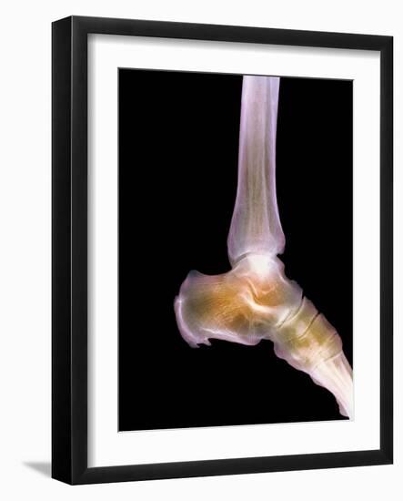 Healthy Ankle, X-ray-Science Photo Library-Framed Photographic Print