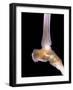 Healthy Ankle, X-ray-Science Photo Library-Framed Photographic Print