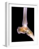 Healthy Ankle, X-ray-Science Photo Library-Framed Photographic Print