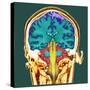 Healthy Brain, MRI Scan-Science Photo Library-Stretched Canvas