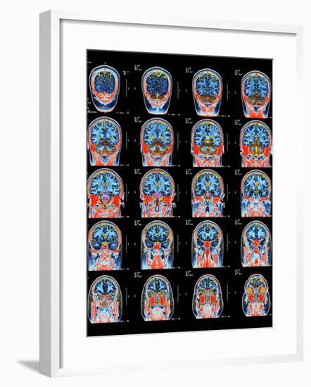 Healthy Brain, MRI Scans-Science Photo Library-Framed Photographic Print