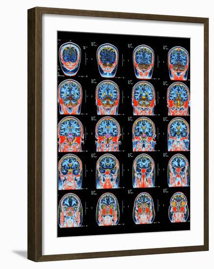 Healthy Brain, MRI Scans-Science Photo Library-Framed Photographic Print