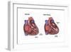 Healthy Heart vs. Heart Failure-Spencer Sutton-Framed Art Print