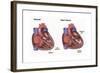 Healthy Heart vs. Heart Failure-Spencer Sutton-Framed Art Print