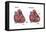 Healthy Heart vs. Heart Failure-Spencer Sutton-Framed Stretched Canvas