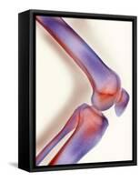 Healthy Knee, X-ray-Science Photo Library-Framed Stretched Canvas