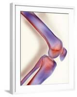 Healthy Knee, X-ray-Science Photo Library-Framed Photographic Print