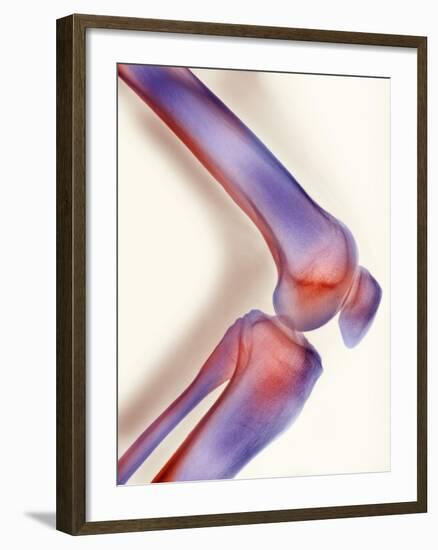 Healthy Knee, X-ray-Science Photo Library-Framed Photographic Print