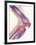 Healthy Knee, X-ray-Science Photo Library-Framed Photographic Print