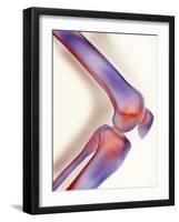 Healthy Knee, X-ray-Science Photo Library-Framed Photographic Print