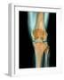 Healthy Knee, X-ray-Science Photo Library-Framed Photographic Print