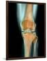 Healthy Knee, X-ray-Science Photo Library-Framed Photographic Print