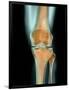 Healthy Knee, X-ray-Science Photo Library-Framed Photographic Print