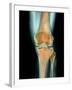 Healthy Knee, X-ray-Science Photo Library-Framed Photographic Print