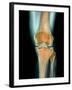 Healthy Knee, X-ray-Science Photo Library-Framed Photographic Print