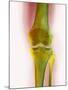 Healthy Knee, X-ray-Science Photo Library-Mounted Photographic Print