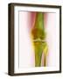 Healthy Knee, X-ray-Science Photo Library-Framed Photographic Print