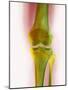 Healthy Knee, X-ray-Science Photo Library-Mounted Photographic Print