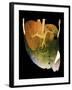 Healthy Liver, CT Scan-ZEPHYR-Framed Photographic Print