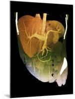 Healthy Liver, CT Scan-ZEPHYR-Mounted Photographic Print
