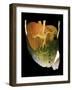 Healthy Liver, CT Scan-ZEPHYR-Framed Photographic Print