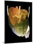 Healthy Liver, CT Scan-ZEPHYR-Mounted Photographic Print