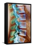 Healthy Lower Spine, X-ray-Science Photo Library-Framed Stretched Canvas