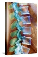 Healthy Lower Spine, X-ray-Science Photo Library-Stretched Canvas