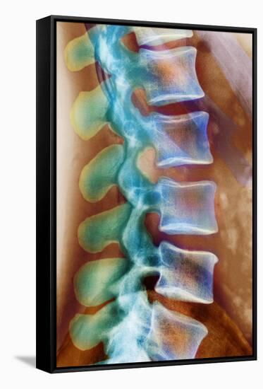 Healthy Lower Spine, X-ray-Science Photo Library-Framed Stretched Canvas