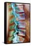 Healthy Lower Spine, X-ray-Science Photo Library-Framed Stretched Canvas