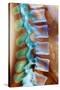 Healthy Lower Spine, X-ray-Science Photo Library-Stretched Canvas