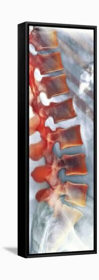 Healthy Lower Spine, X-ray-Science Photo Library-Framed Stretched Canvas